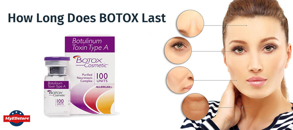 How Long Does Botox Last
